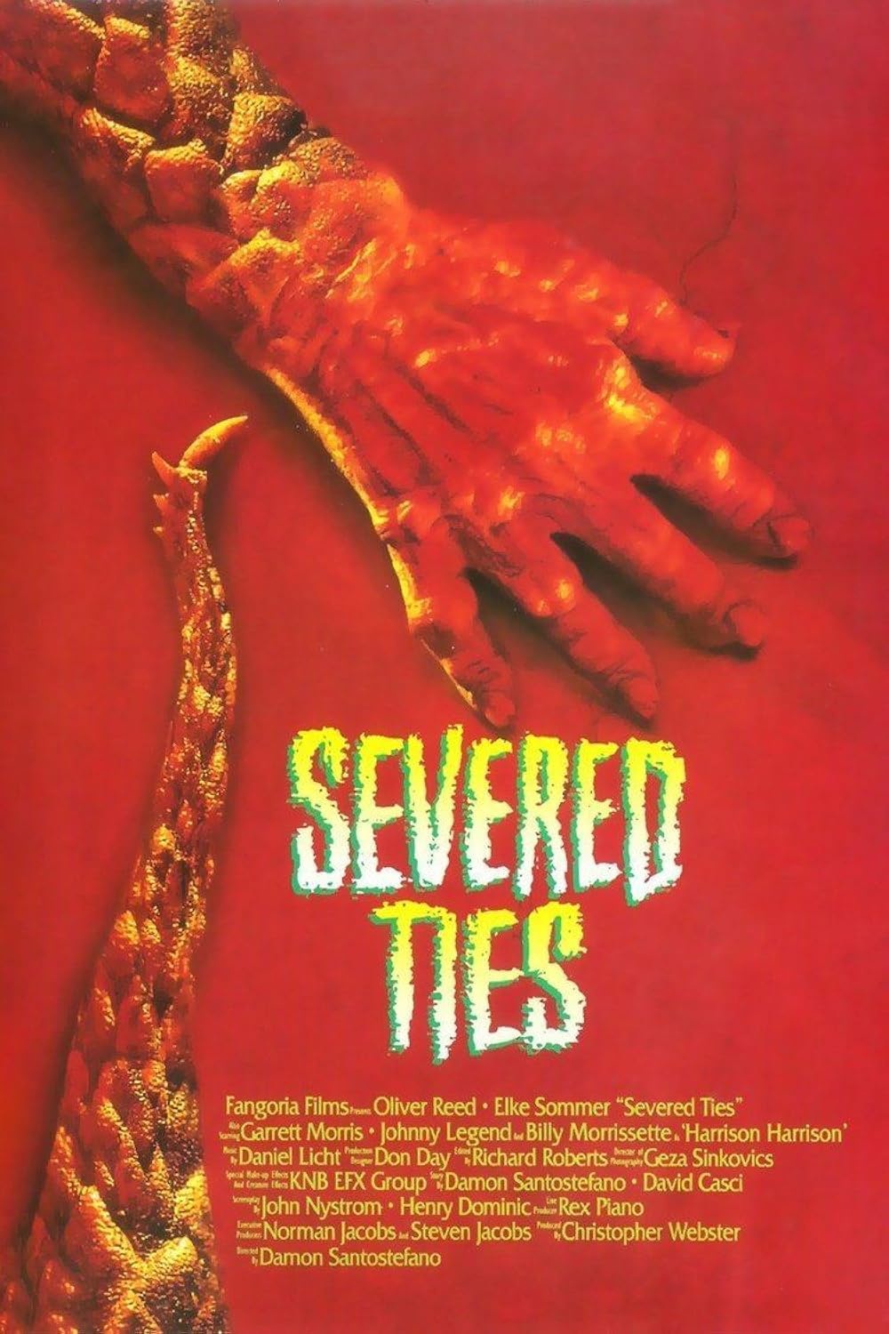 Severed Ties Movie on DVD (1992) 1 Severed Ties Movie on DVD (1992)