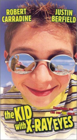 The Boy with the X-Ray Eyes Movie on DVD (1999) Starring Dennis Haskins 1 The Boy with the X-Ray Eyes Movie on DVD (1999) Starring Dennis Haskins